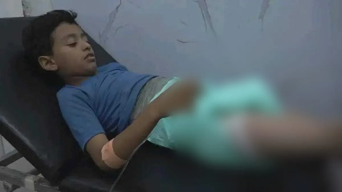 إصابة طفل برصاص قناص حوثي في تعز