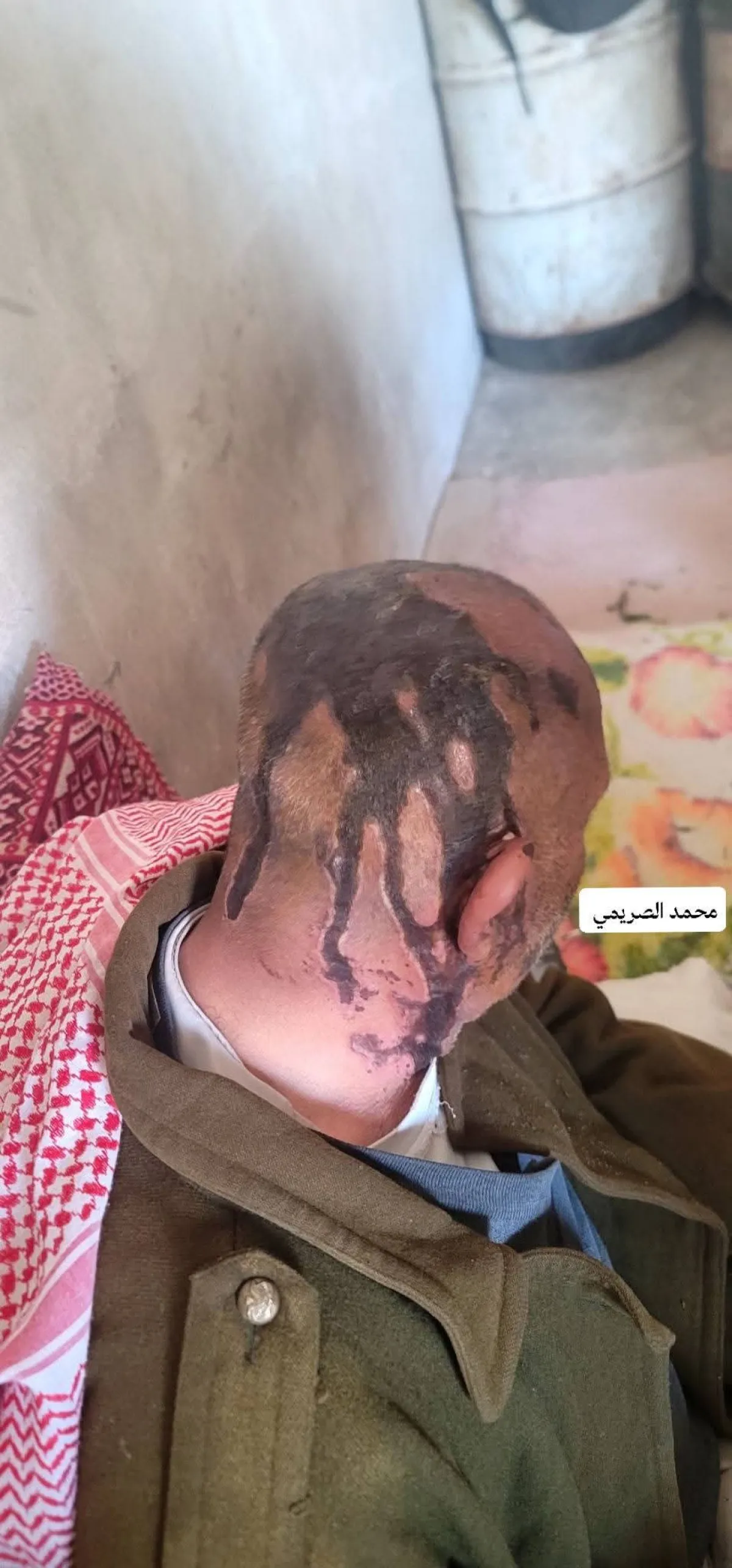 عمران.. شابان يعتديان على والدهما المسن ويرشانه بمادة حارقة