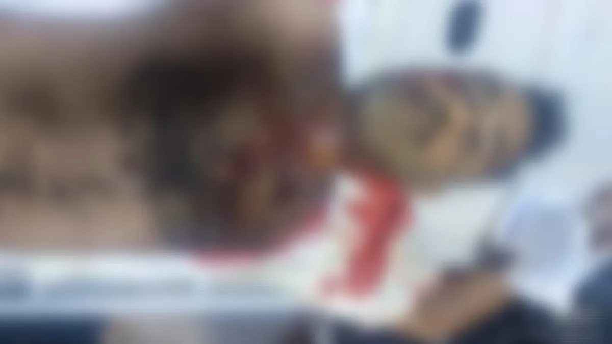 حجة.. قصف حوثي يستهدف مدنيين أثناء الإفطار في حيران يسفر عن 8 شهداء