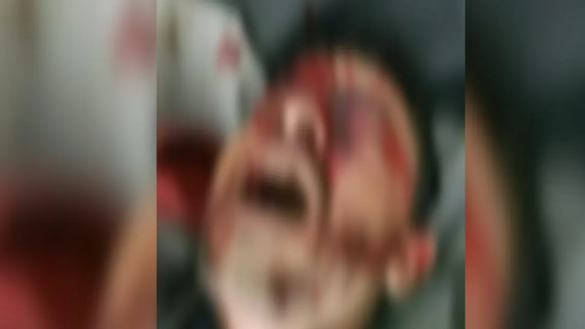 قتيل وثلاثة جرحى في اشتباكات قبلية بعمران