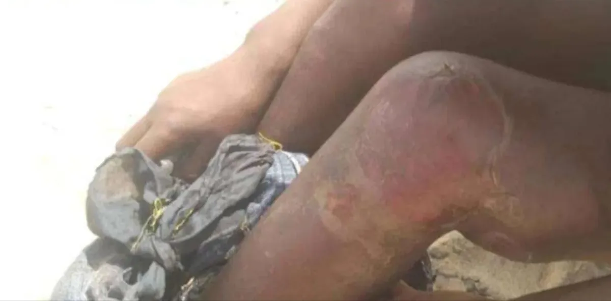 شيخ قبلي في أبين يحذر من "معتقلات سرية" لتعذيب مهاجرين ويدعو لتحرك عاجل