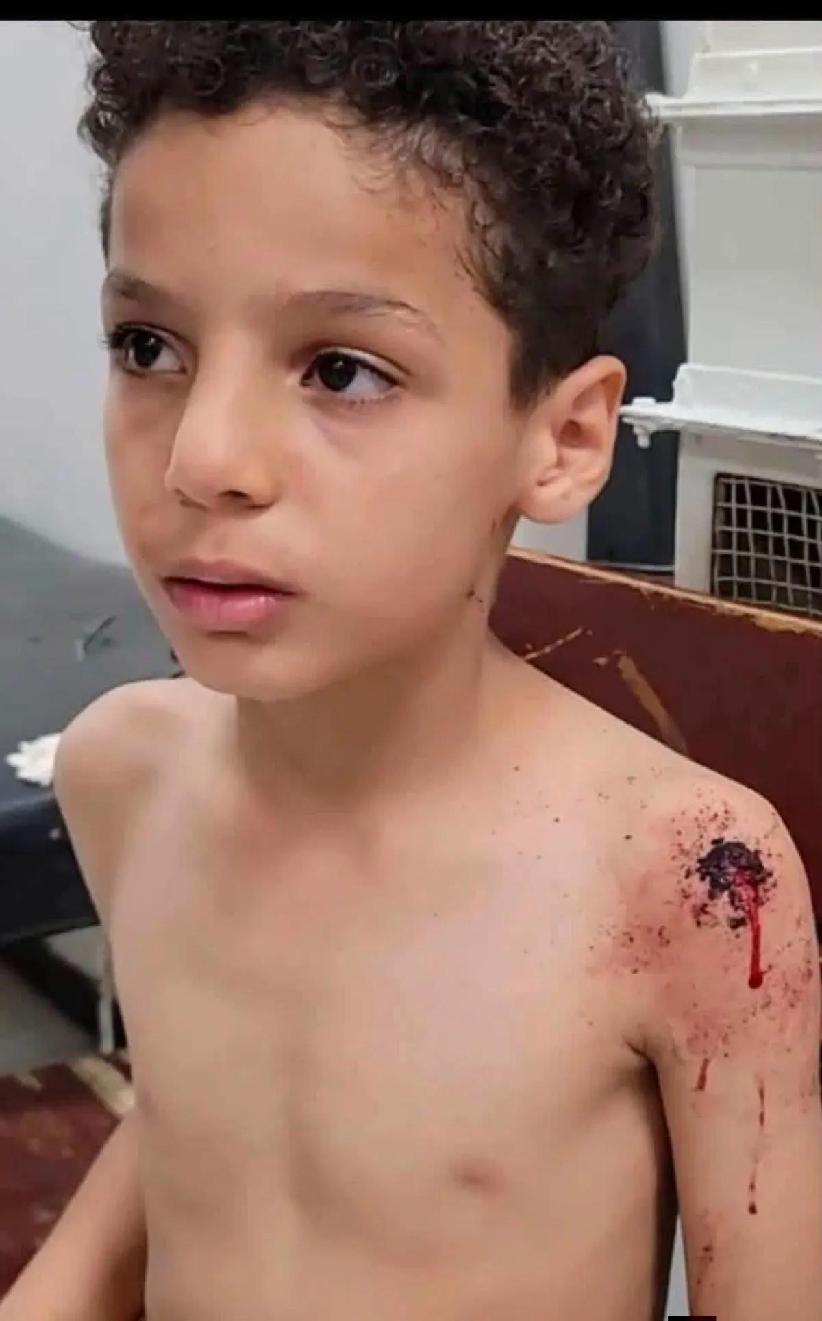تعز.. إصابة طفل بشظية جراء قذيفة حوثية سقطت على حي سكني